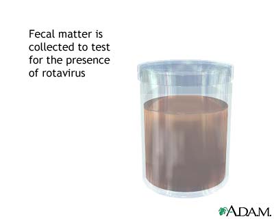Fecal sample Fecal sample