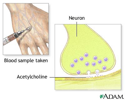 Cholinesterase test Cholinesterase test