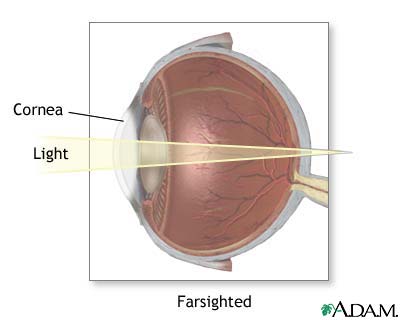 Farsighted Farsighted