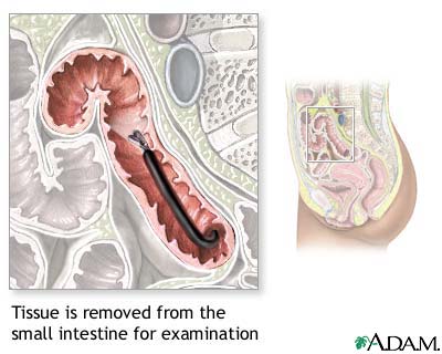 Small intestine tissue sample Small intestine tissue sample