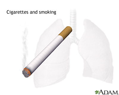 Smoking hazards