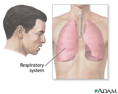 Symptoms Symptoms