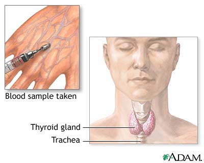 Thyroid function test Thyroid function test