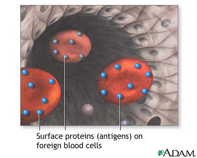 Surface proteins causing rejection Surface proteins causing rejection