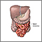 Meckel's diverticulectomy - normal anatomy