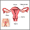 Barrier methods of birth control - Series