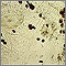 Scabies mite - photomicrograph of the stool