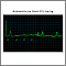 Atrioventricular block - ECG tracing