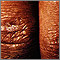 Dermatomyositis - Gottron papule