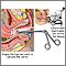 Colposcopy-directed biopsy