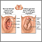 Developmental disorders of the vagina and vulva
