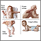 Infantile reflexes