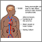 Obesity and health