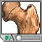 Osteoporosis Osteoporosis