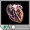 Arrhythmias Arrhythmias