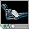 Preeclampsia Preeclampsia