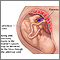 Substance use during pregnancy