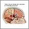 Brain tumor