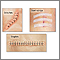 Incision closures