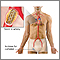Coronary artery stent