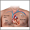 Pacemaker
