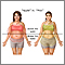 Different types of weight gain