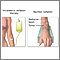 Radiation therapy