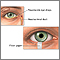 Schirmer's test