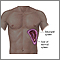 Enlarged spleen