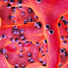 Bone Infections