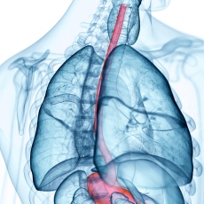 Esophageal Cancer