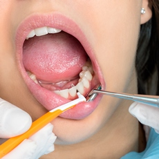 Mouth Disorders