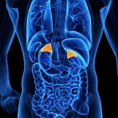 Pheochromocytoma