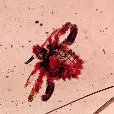 Pubic Lice