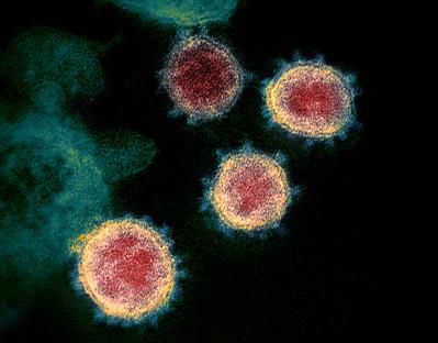 Microscopic image of four SARS-CoV-2 virus particles, the virus that causes COVID-19. Spike proteins are seen surrounding the outer membrane of each virus particle.