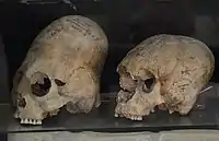 Deformed skulls, Afrasiab, Samarkand, Sogdia, 600–800 CE