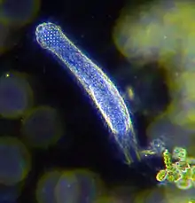 Darkfield photo of a gastrotrich, 0.06-3.0&nbsp;mm long, a worm-like animal living between sediment particles