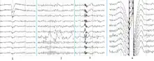 Main types of artifacts in human EEG