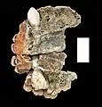 Burial 3 - Abnormal growth of the canines.