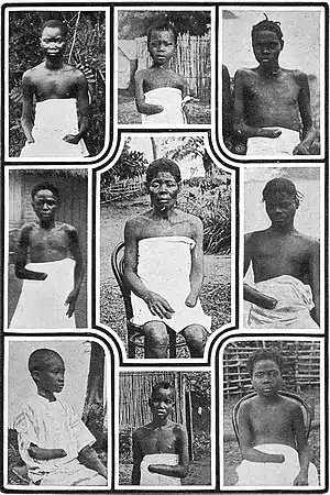 Image 42Children mutilated during King Leopold II's rule (from History of the Democratic Republic of the Congo)